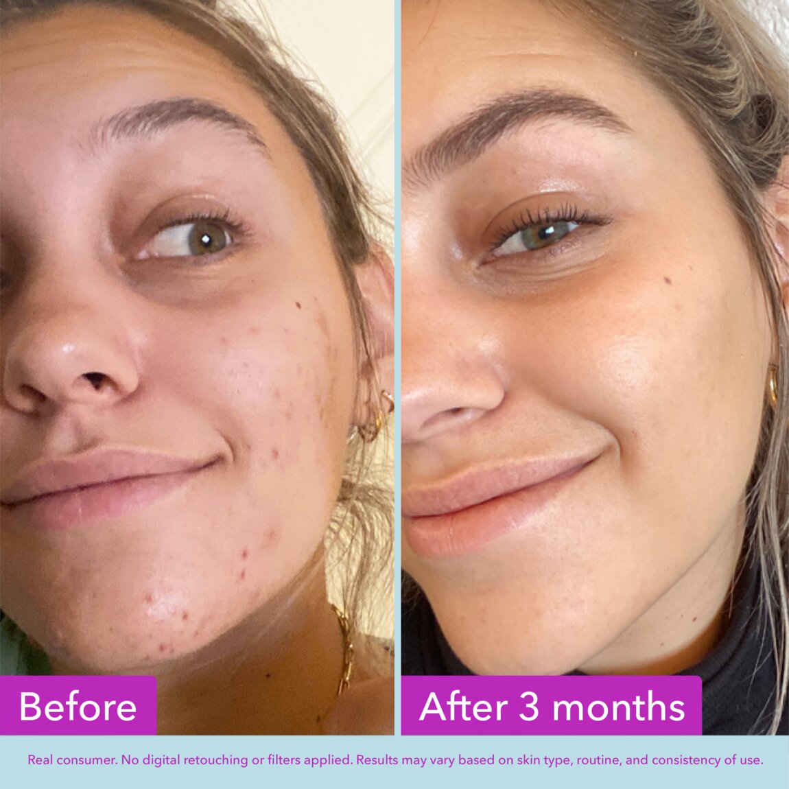niacinamide-brightening-toner-z0 zb_p.jpg