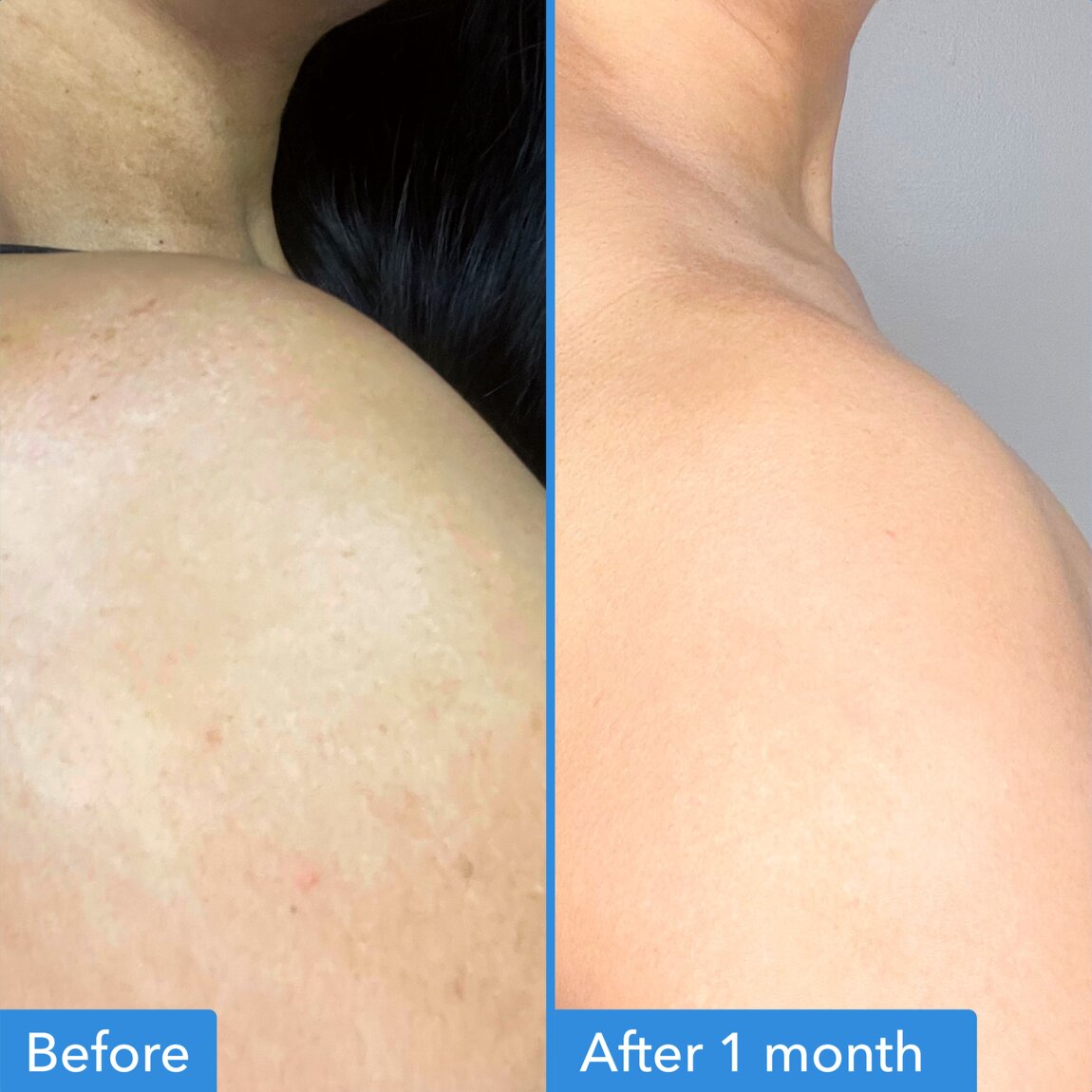 discoloration-correcting-body-treatment-k1 zb_p.jpg